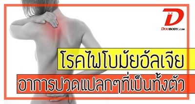 วิธีจัดการกับอาการปวด Fibromyalgia