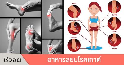 เคล็ดลับในการรับมือกับอาการของโรคเกาต์